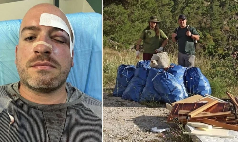 Πάρνηθα: Επτά άτομα επιτέθηκαν στους εθελοντές- Νέες φωτογραφίες από τους τραυματίες